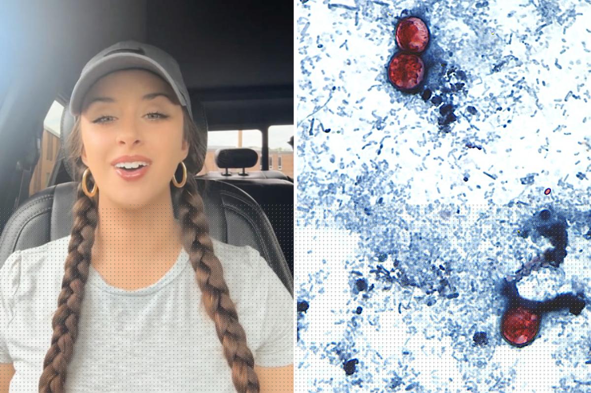 TikTok food critic, 29, details ‘miserable’ experience of contracting ‘explosive diarrhea’ parasite